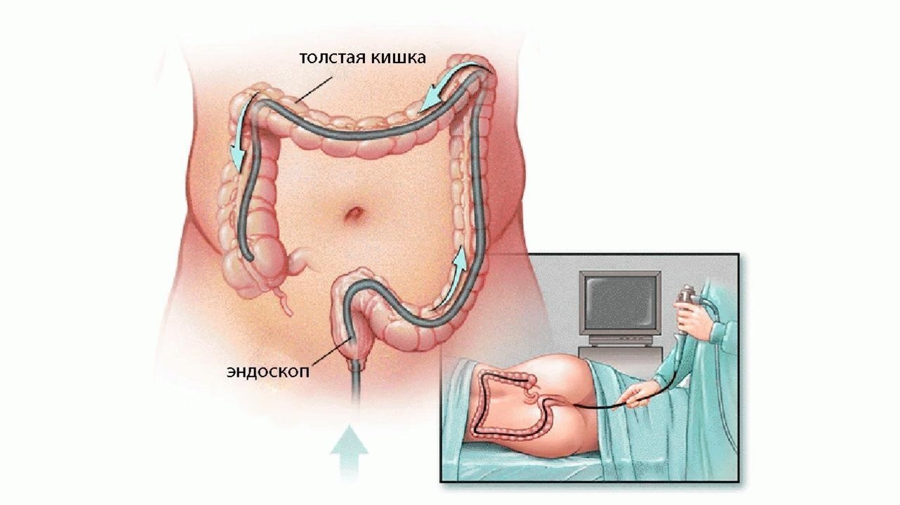 Doctor remove dildo rectum