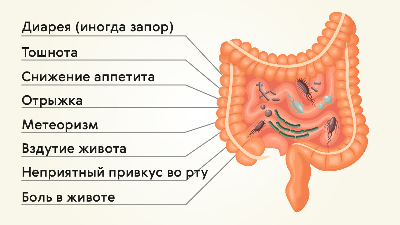 Условно патогенная флора дисбактериоз