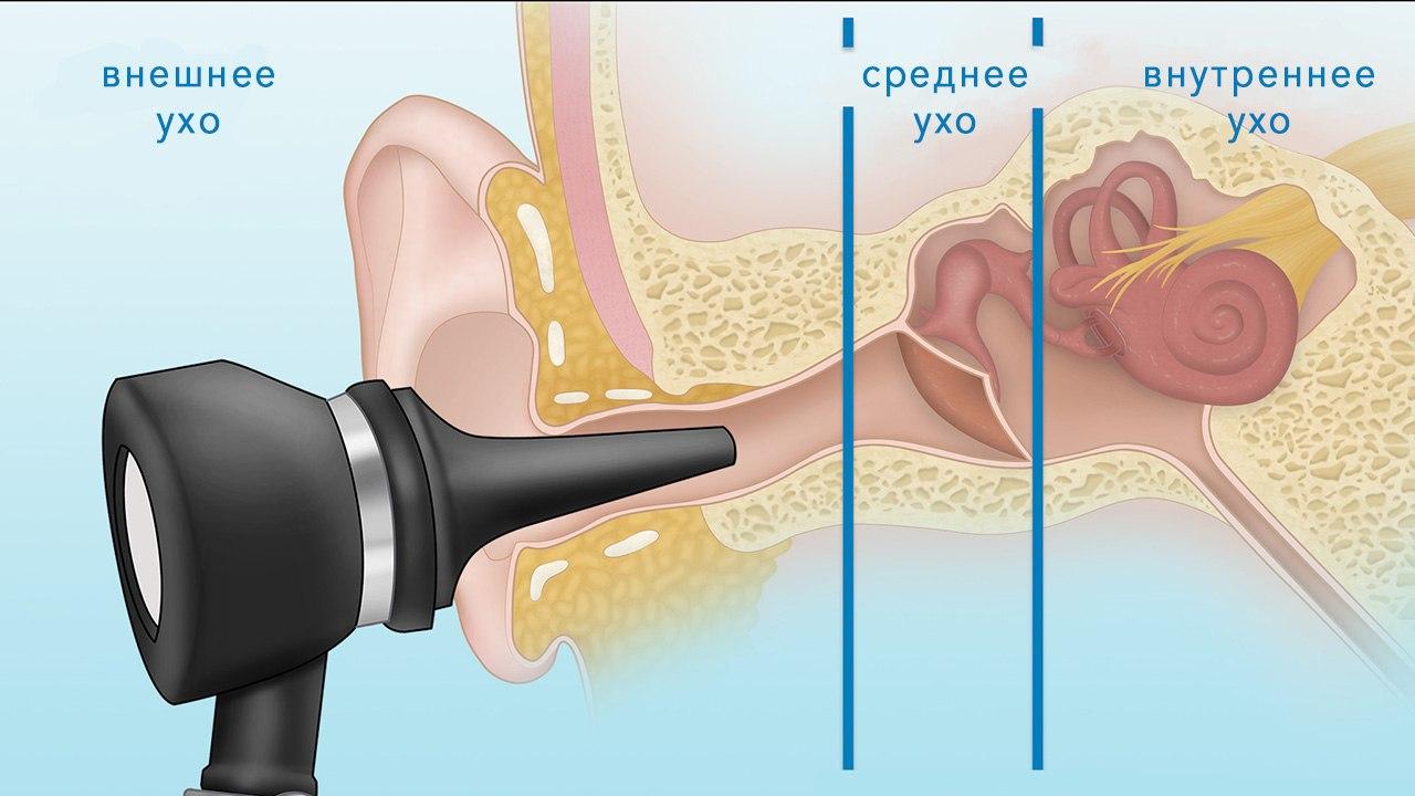 Операция на ухо при отите внутреннего уха