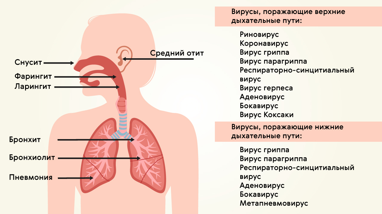 Синдром пневмонии при инфекционных заболеваниях