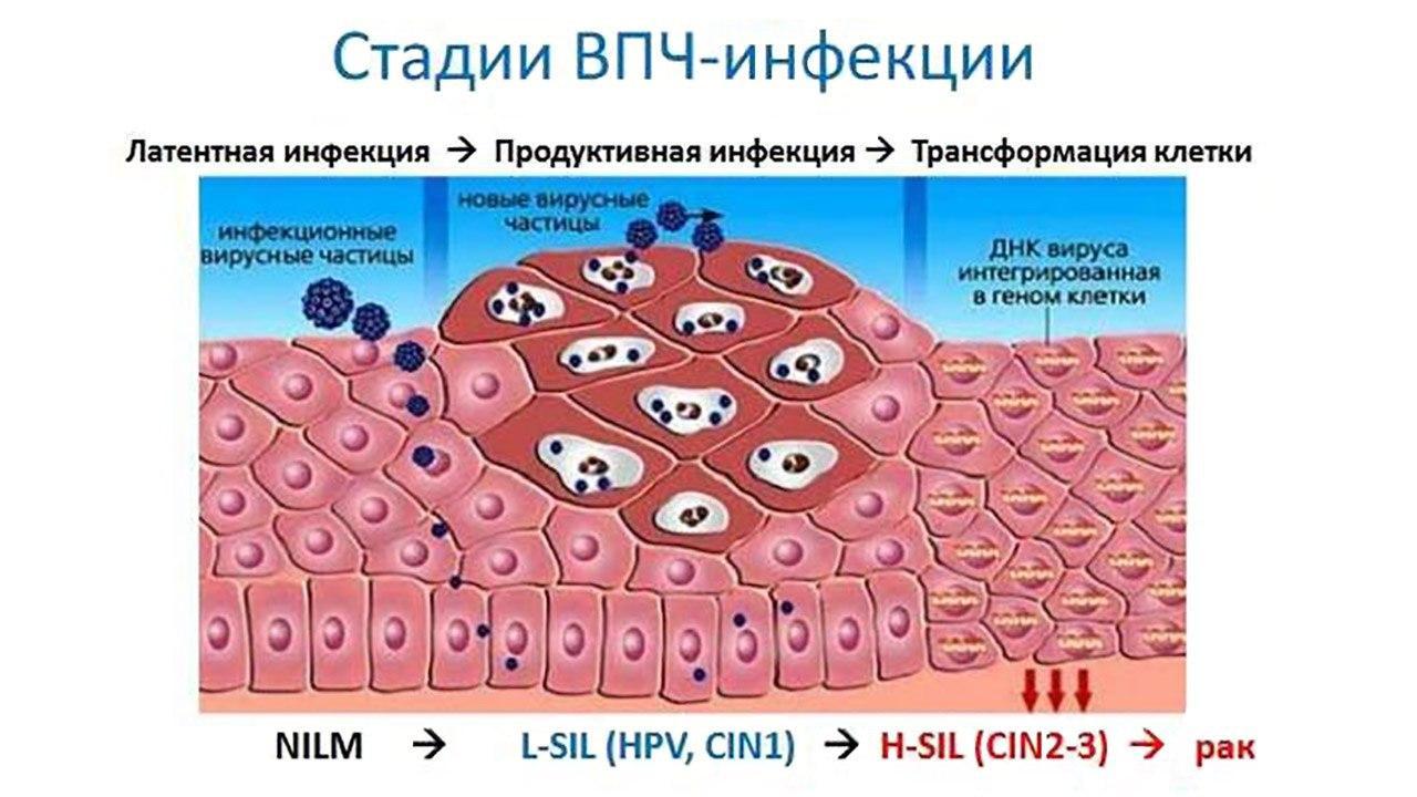 Впч у женщин и сыпь