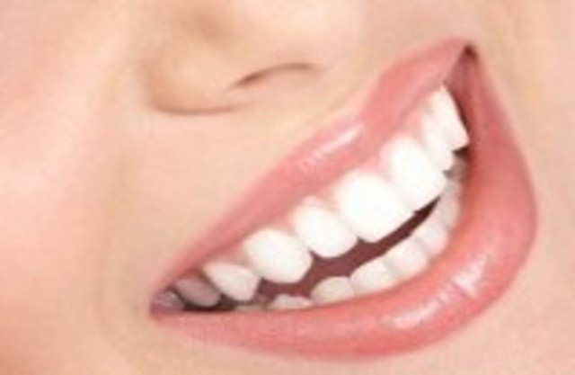 Виды улыбок в стоматологии фото и названия