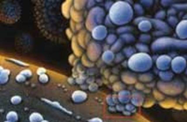 Аутоиммунные заболевания. Ревматология