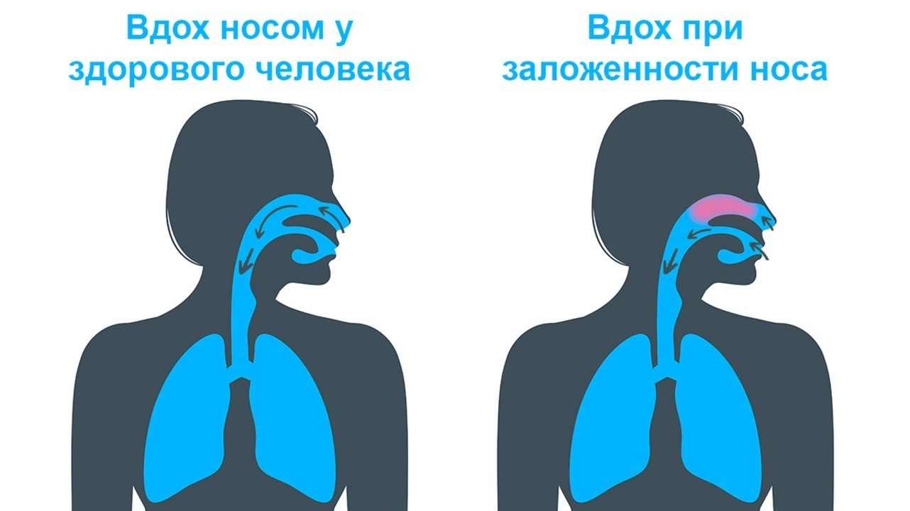 Лечение носа: народная мудрость против науки