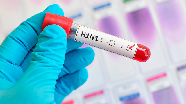 «Свиной» грипп: распознать и обезвредить