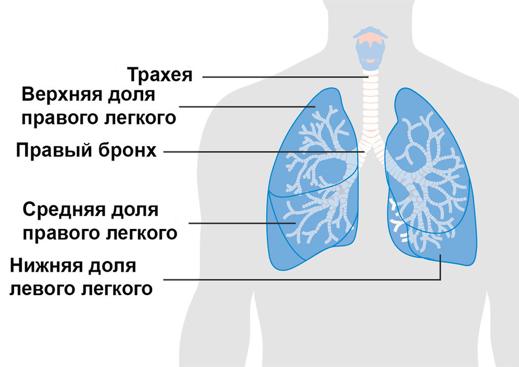 Двухсторонняя пневмония фото
