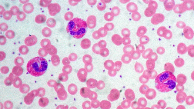 Эозинофилы в крови: что необходимо знать?