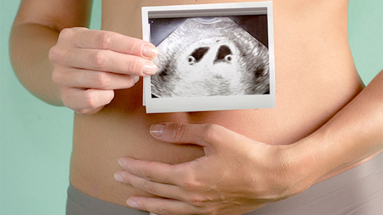 Как возникает многоплодная беременность