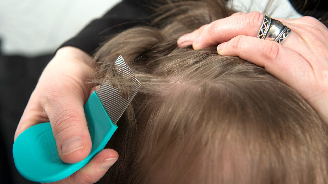 Что делать с катышками на волосах у ребенка