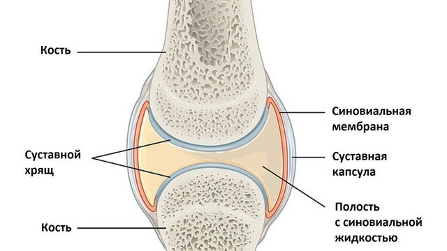 hogyan lehet kezelni az osteochondrozist és az artrózist