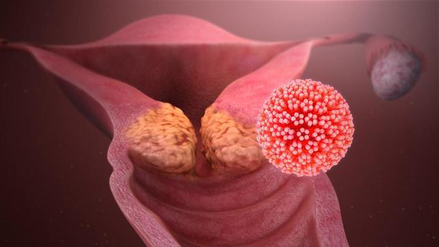 HPV-szűrés és tipizálás - bekaminai.lt