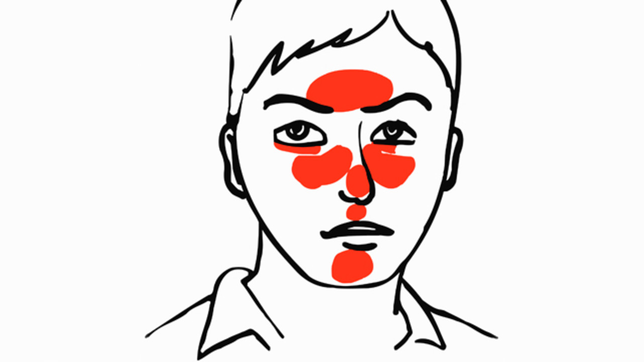 Розацеа: болезнь красного носа