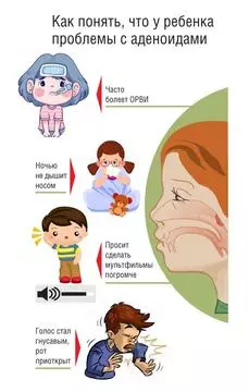 Памятка по симптомам воспаления аденоидов у ребенка.