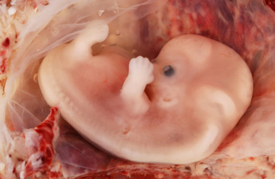 Мифы об эмбрионах