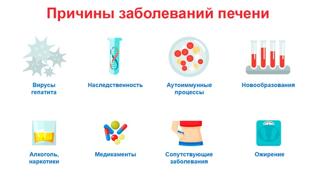 Инфографика: причины заболевания печени На изображении представлена инфографика с перечислением причин заболеваний печени. Среди них: вирусы, наследственность, иммунные процессы, злоупотребление алкоголем, медикаменты, метаболические нарушения, паразитарные заболевания и ожирение