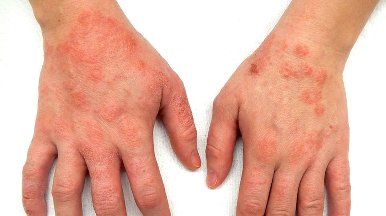 Лечение кожных заболеваний: виды, симптомы, фото и описание