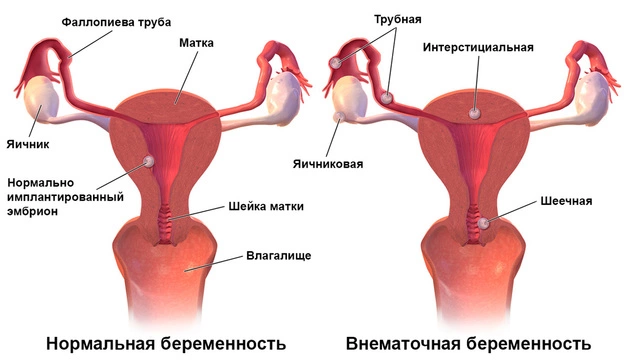 Какими бывают вагины