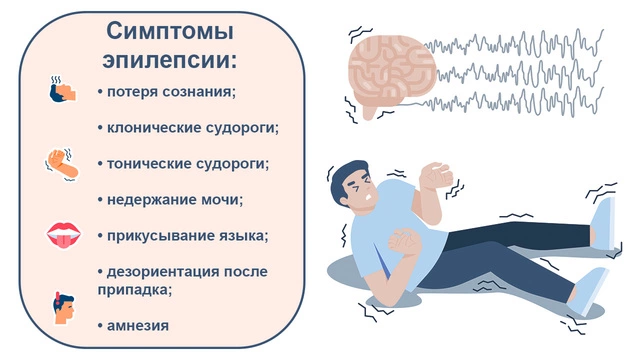 На изображении представлен информационный плакат, посвященный симптомам эпилепсии.