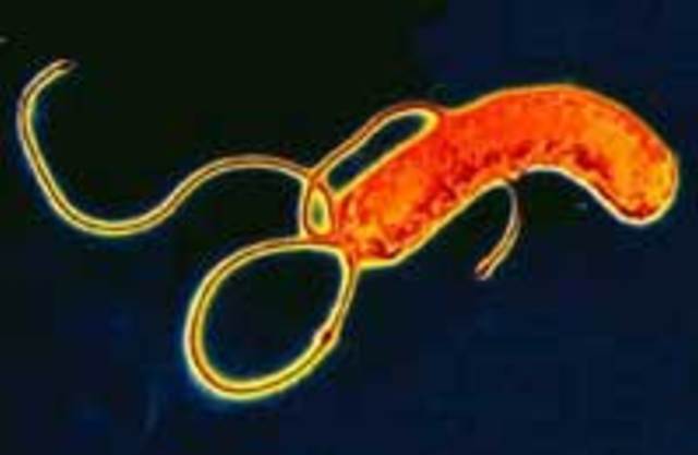 Helicobacter pylori при язве 12 thumbnail