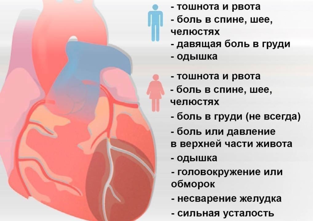 Причины боли сердца у мужчин. Инфаркт миокарда сердце. Сердце инфаркт миокарда симптомы.