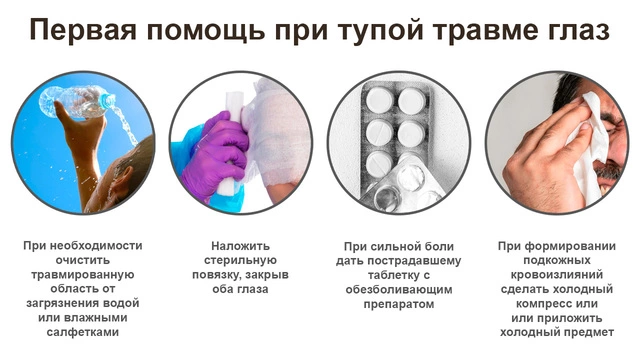 Первая помощь при тупой травме глаз Несколько важных советов с иллюстрациями о первой помощи при тупой травме глаз