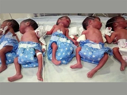 Женщина родила пятерняшек неожиданно для себя и врачей
