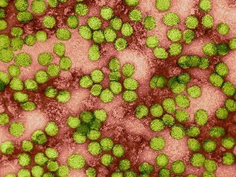 Новый тест обнаружит 416 тропических вирусов