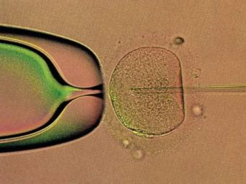 Московским клиникам [запретят подсаживать более двух эмбрионов при ЭКО]