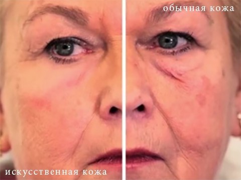 «Вторая кожа» против морщин