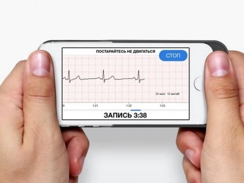 Чехол для iPhone поможет сделать кардиограмму и отправить ее врачу