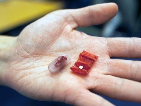 Складной робот из мяса поможет извлечь проглоченные батарейки