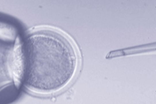 Клиника искусственного оплодотворения перепутала сперму пациентов