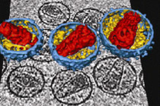 Ученым удалось воссоздать трехмерную структуру вируса СПИДа