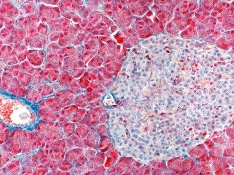 Из стволовых клеток пациентов с диабетом создали бета-клетки