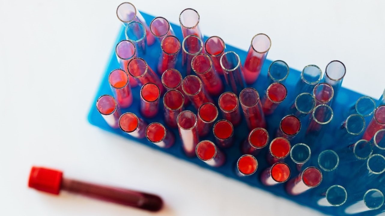 Ученые нашли новые связи между группой крови и риском некоторых болезней