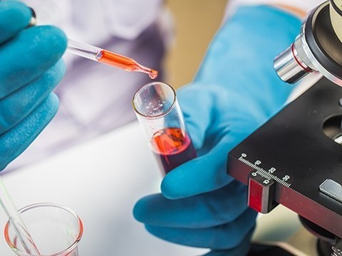 Получены новые данные о происхождении гепатита А