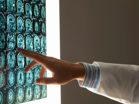 Скрининговые программы позволили на 70% увеличить диагностику онкологии у россиян