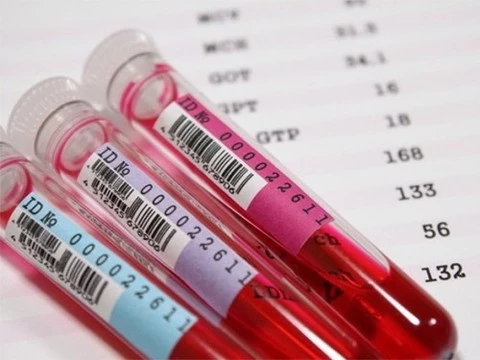 Риск преждевременной смерти определят с помощью анализа крови