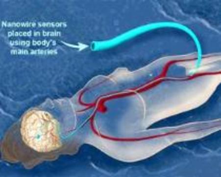 Платиновые нанопровода будут встраивать в мозг