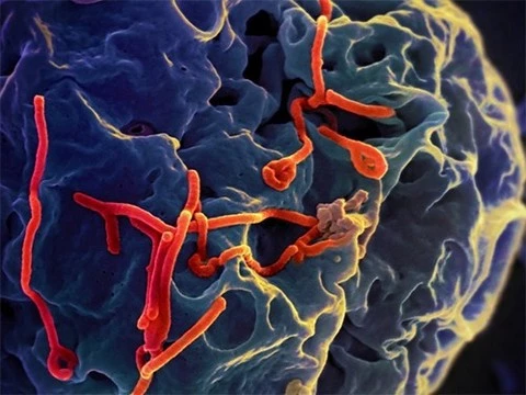 Еще один эболавирус может стать причиной новой эпидемии