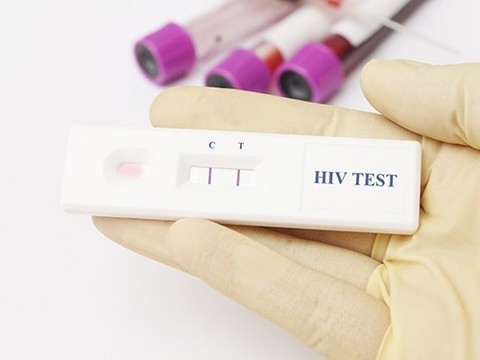 Экспресс-тесты на ВИЧ: история успеха