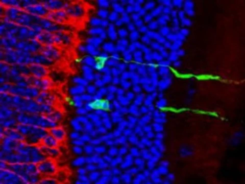 Терапию слепоты с помощью стволовых клеток испытают на людях [через пять лет]