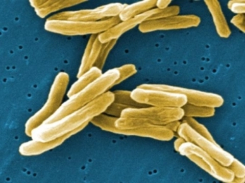 ВОЗ предупредила [о возвращении туберкулеза в Европу]