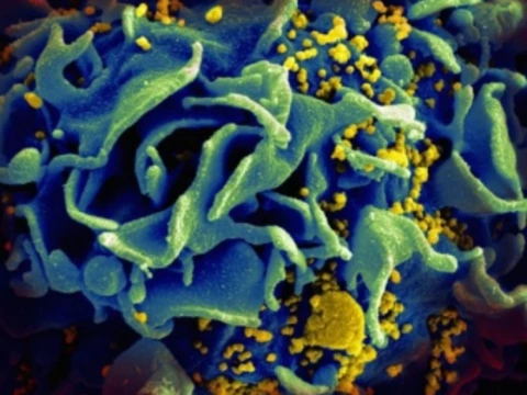 [Американцы объяснили] избирательное поражение Т-лимфоцитов при ВИЧ-инфекции