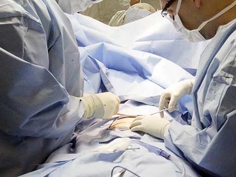 Ежегодно хирурги удаляют тысячи здоровых аппендиксов