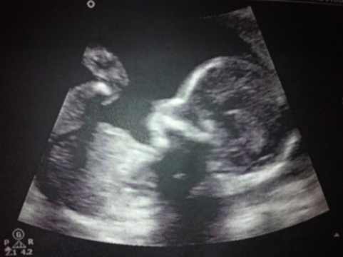 Фото узи на 4 месяце беременности