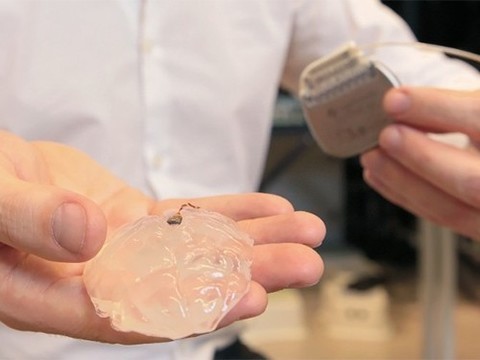 Парализованные обезьяны смогли снова ходить