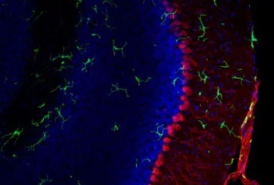 Трансплантация костного мозга [улучшила состояние мышей с синдромом Ретта]