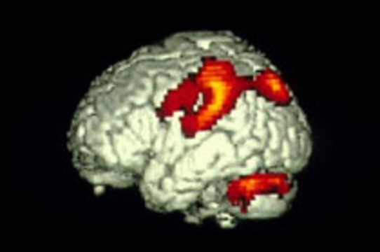 Найти лжеца поможет сканирование головного мозга