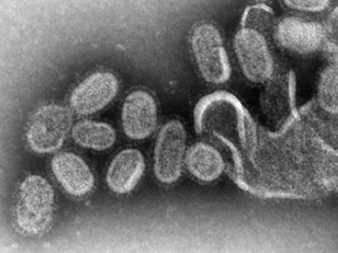 Число умерших от гриппа H1N1 россиян [достигло 11]